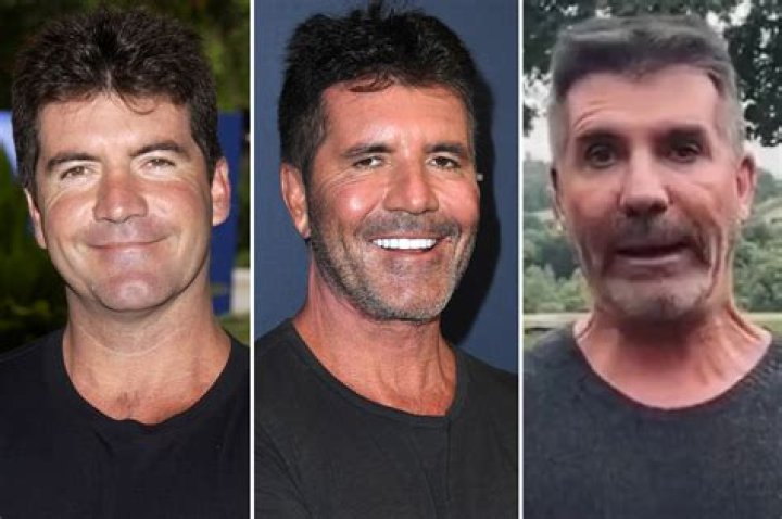 Devastating News: Simon Cowell's X Factor Cancer Battle Revealed