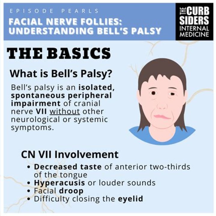 Discover Notable Figures Affected By Bell's Palsy