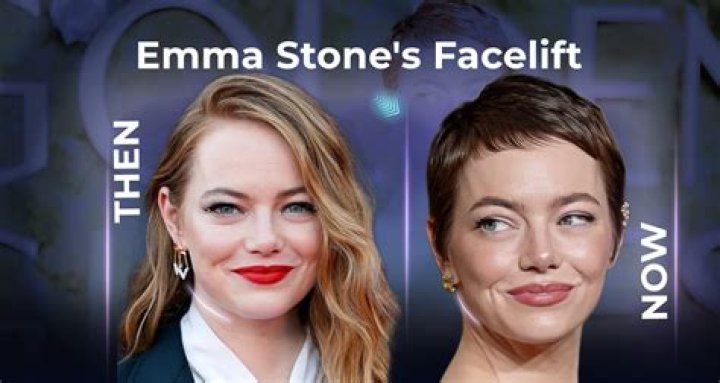 Discover The Age Of Emma Stone's Little One: Unveiling The Truth Behind "How Old Is Emma Stone's Daughter"