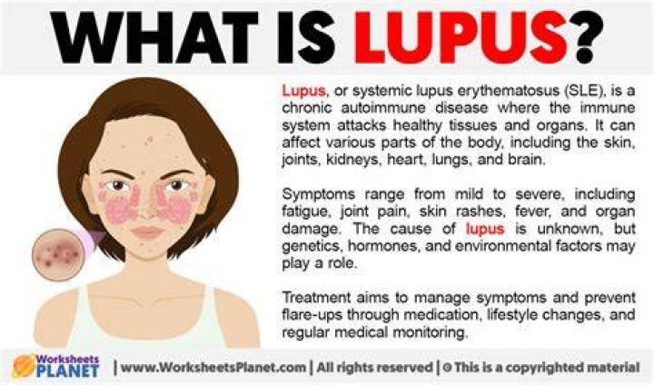 Does Lupus Spread: Unraveling The Facts About Lupus Contagion