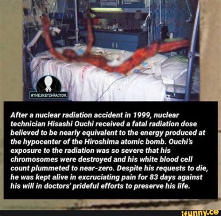 Hisashi Ouchi: The Unbelievable True Story Of Survival And Sacrifice