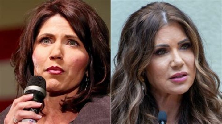 Kristi Noem's Lips: The Surprising Truth