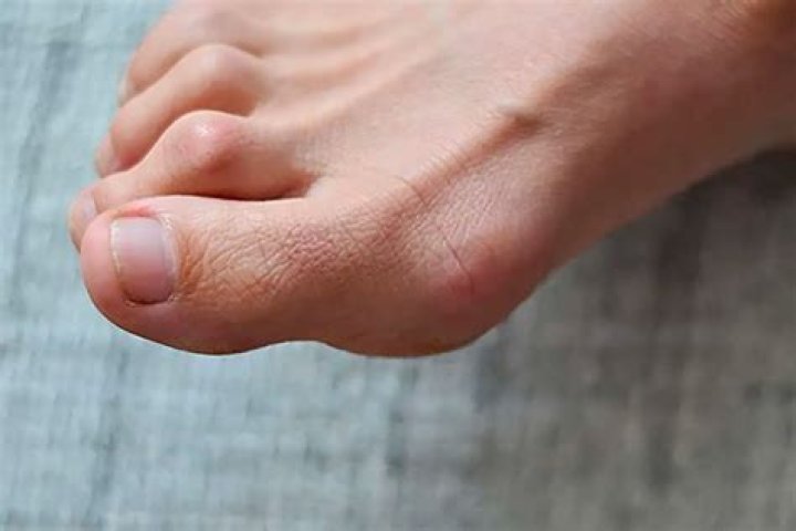 Megan Fox's Stunning Toes: An Exploration Of Beauty And Elegance