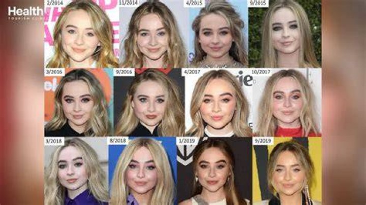 Sabrina Carpenter's Transformation: Before And After Filler