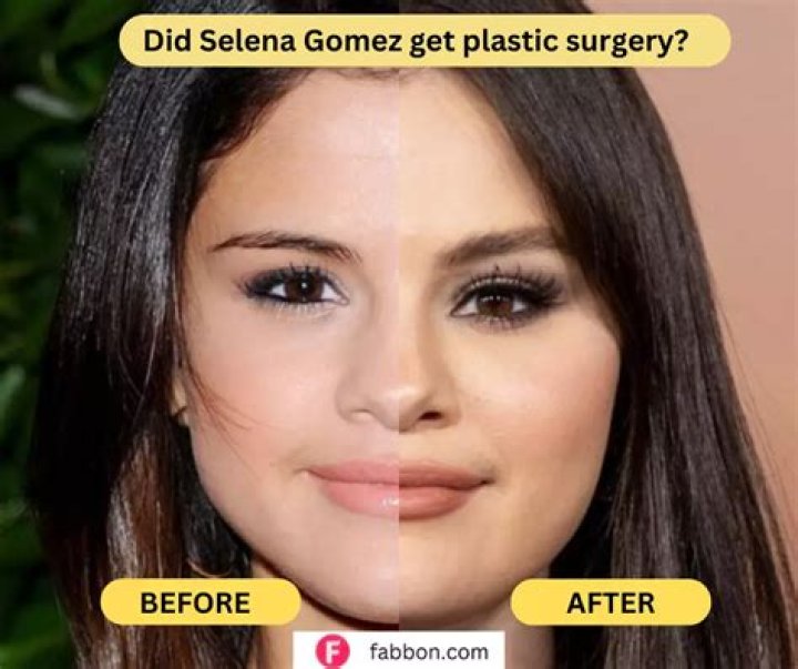 Selena's Stunning Transformation: A Side-by-Side Comparison