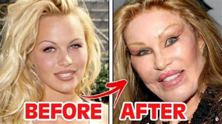 The Perils Of Cosmetic Surgery: The Cautionary Tale Of The "Botched Implant Guy"