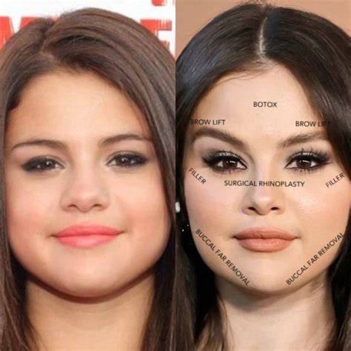 Top Secrets: Selena Gomez's Beauty Transformation Revealed