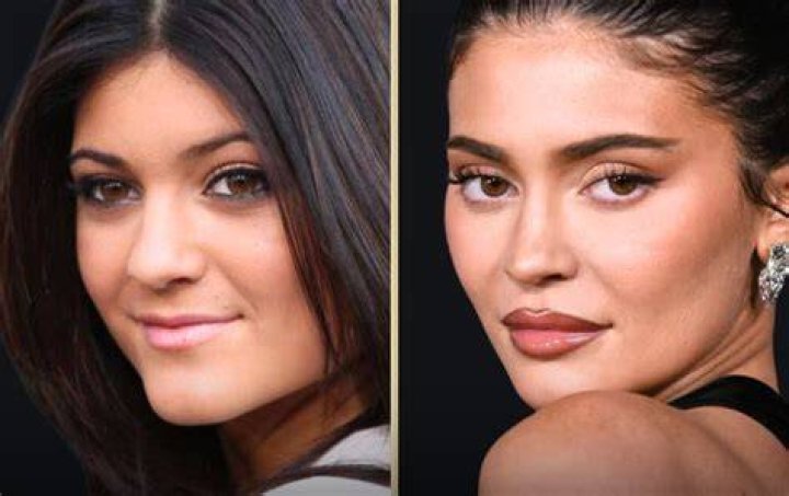 Transformative Weight Loss Journey: Kylie Jenner's Before And After
