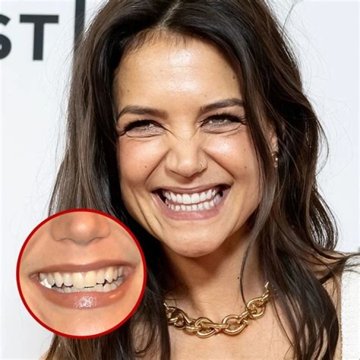 What's Causing Selena Gomez's Unusual Facial Appearance: A Medical Analysis